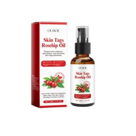 Ouhoe Rosehip Seed Wart Essence Oil Skin Label Repair And Fade Mole Corns Meat Kernel Essence (Option: 30ml-50g-4.13*1.18*1.18inch)